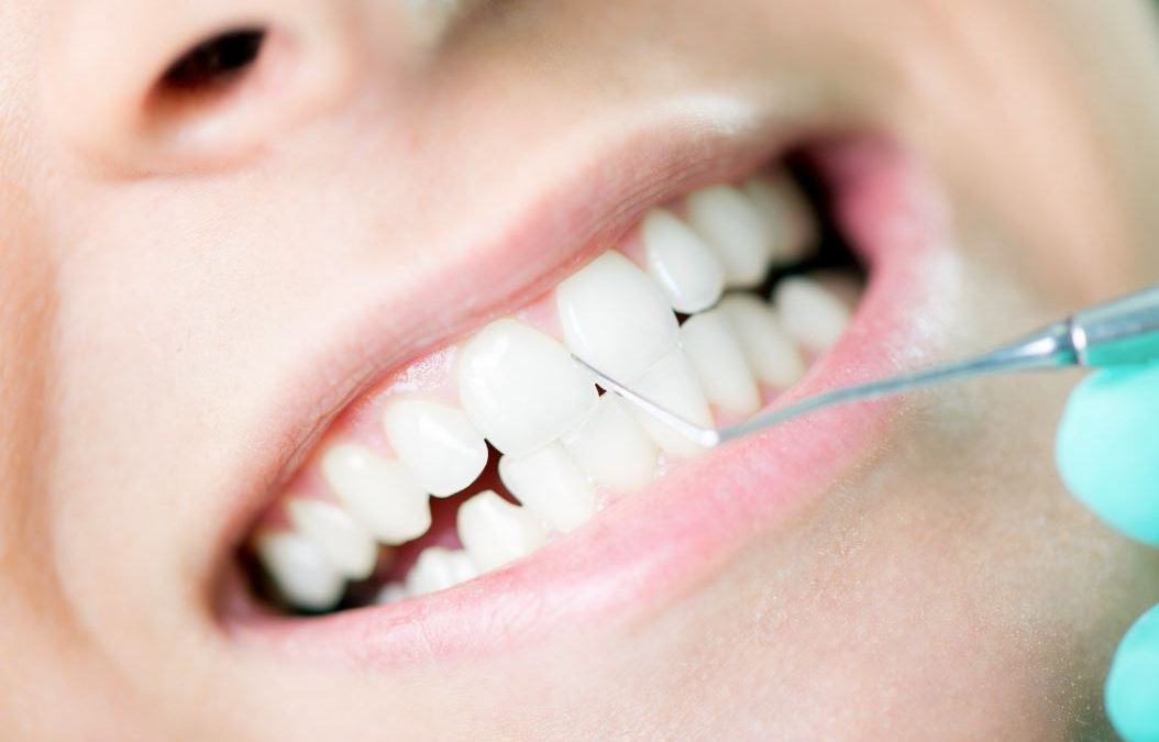 dental cleaning