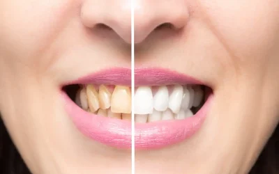 The Effects of Cigarettes on Your Teeth
