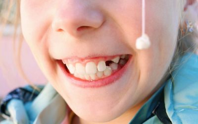 Is It Okay to Pull Loose Teeth?
