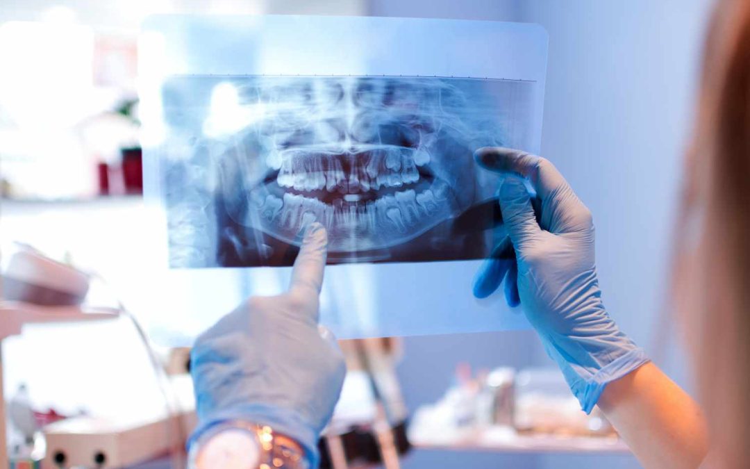 Dental X-rays