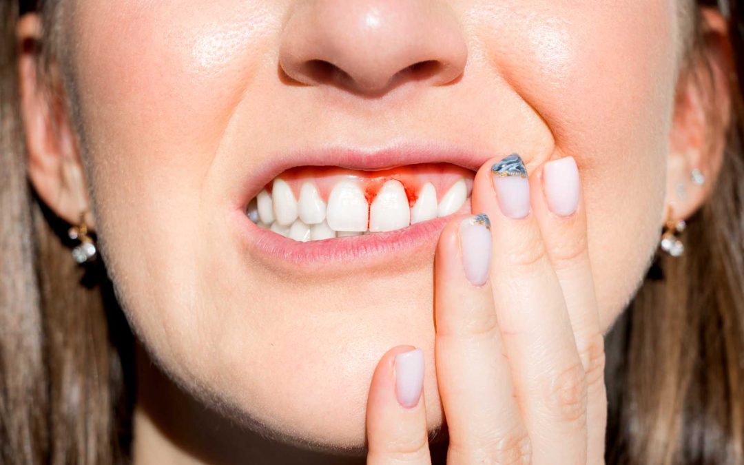 Oral Health Systemic Link