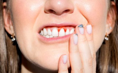 Beyond the Smile: The Oral Health-Body Connection