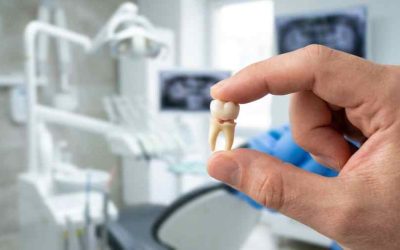 Loose Teeth in Adults and When to Worry